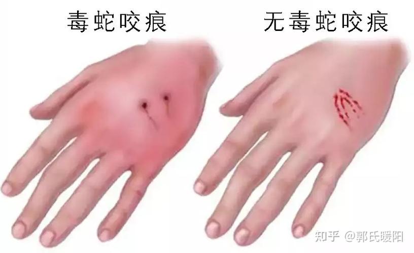 新澳天天开奖资料大全一和女子遭毒蛇咬伤身亡与女子遭毒蛇咬伤身亡视频